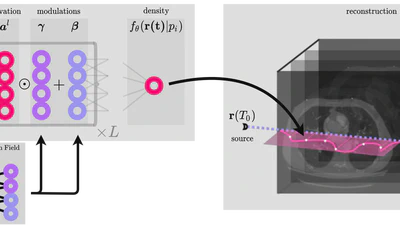 Neural Modulation Fields for Conditional Cone Beam Neural Tomography featured image